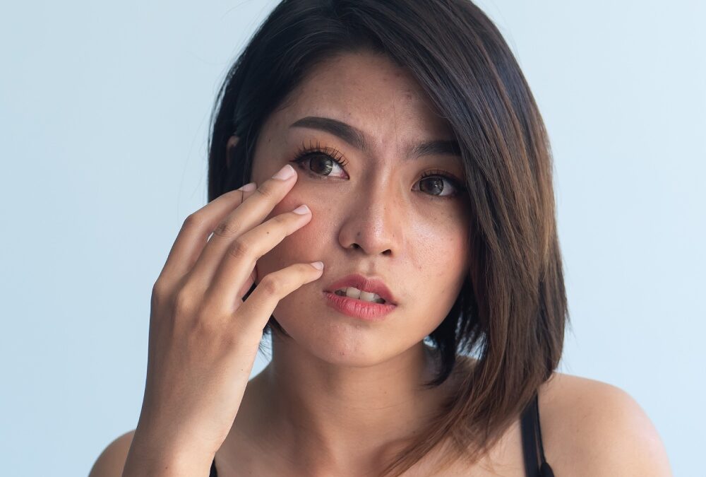 What Can I Do to Relieve Dry Eyes?